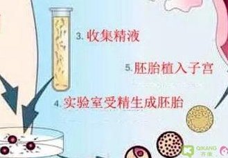 子宫内膜异位症可以做试管吗？