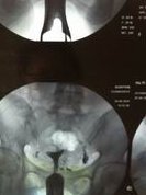 2026北京石景山区生小孩费用参考，妇幼院顺产3000元起步