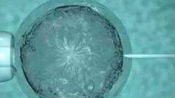 苏州附二院试管婴儿怎么样？一起来了解试管婴儿的常识！